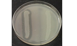 Fat, Lipid Hydrolysis Test
